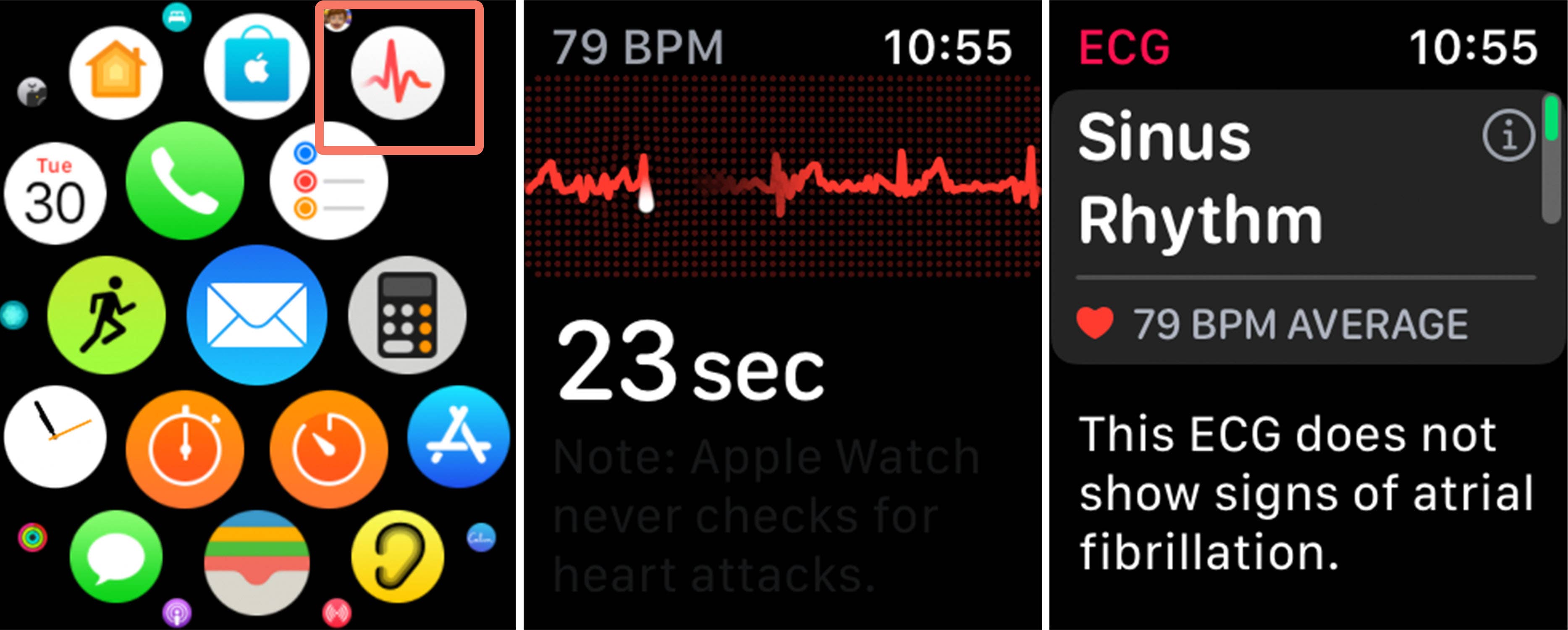 Apple Watch heart rate