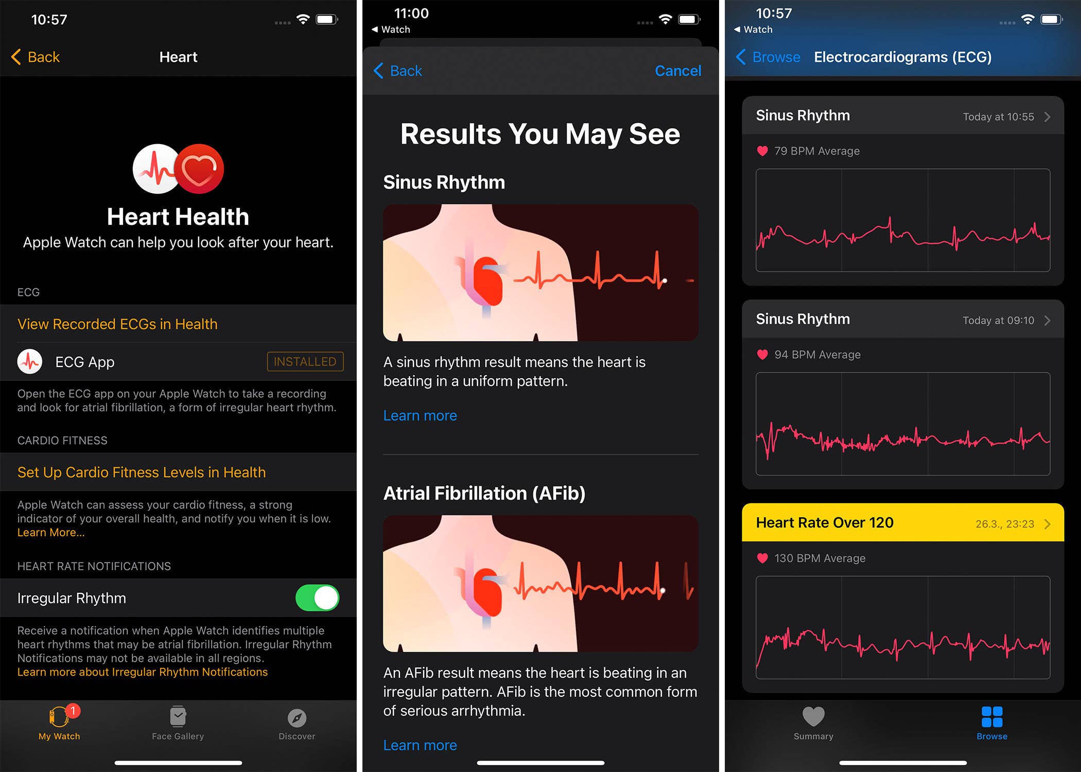 iPhone Apple Health Watch ECG
