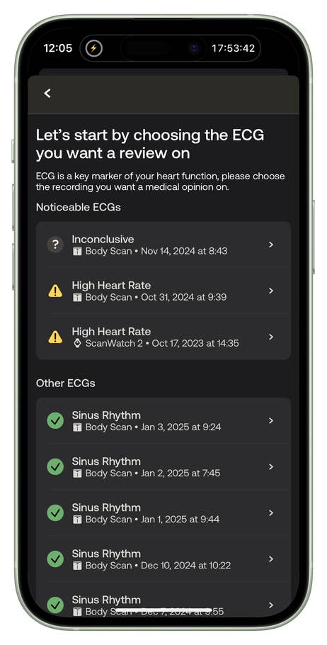 Écran du0027application mobile montrant les options ECG, y compris les alertes du0027incertitude et de fréquence cardiaque élevée.