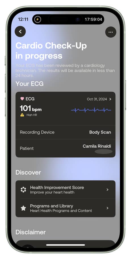 Écran mobile affichant un contrôle cardiaque avec résultats ECG et options du0027amélioration de la santé.