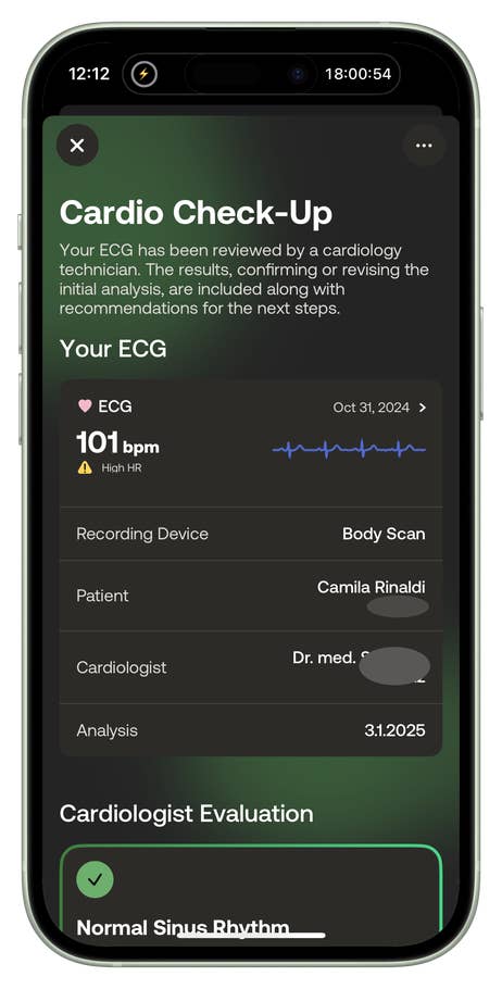Rapport ECG de Withings montrant une fréquence cardiaque de 101 bpm, étiqueté comme haute FC.